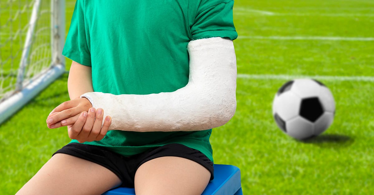 An image of a broken arm