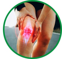 An acute inflammation injury in the knee