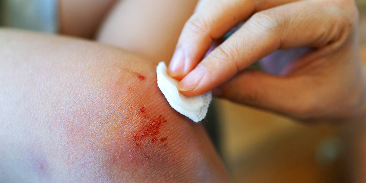 A parent cleans a wound on a child’s knee