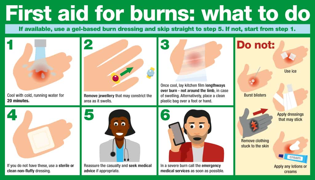 A six-step infographic that describes how to treat a burn injury with first aid 