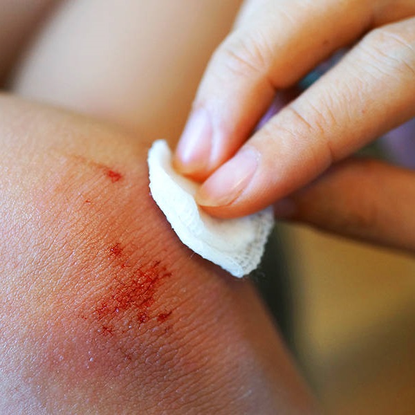 Wound Cleaning for First Aid