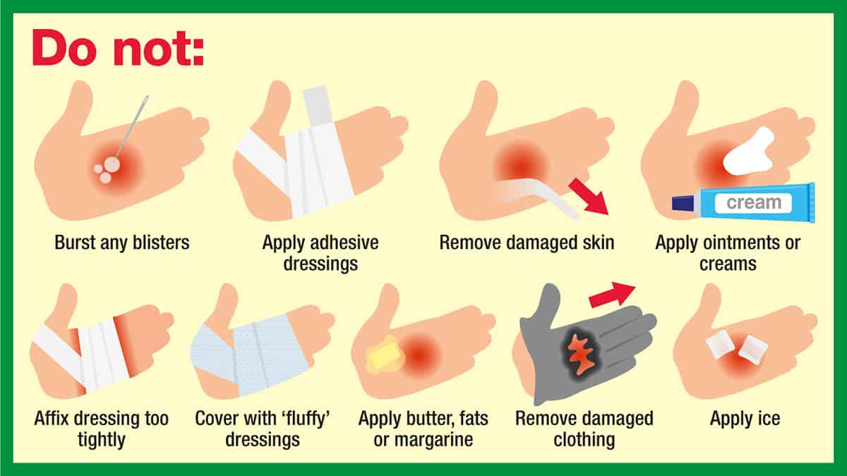 Burns: do not burst blisters, use sticky or fluffy dressings, use creams or ice, remove damaged skin or clothing or wrap dressings tightly