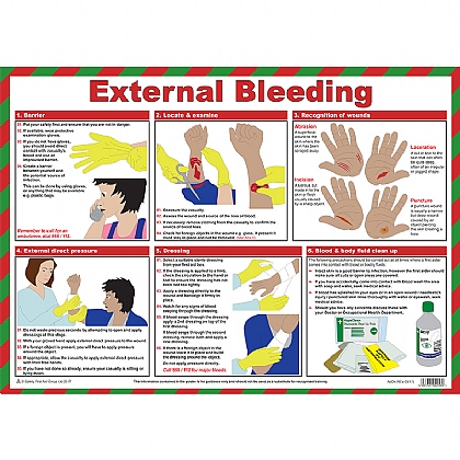 First Aid for External Bleeding Poster